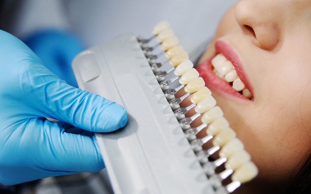 Common Dental Implant Complications