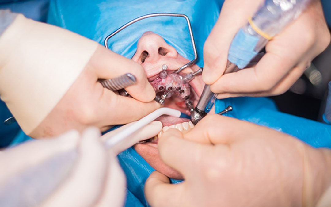 Mouth Reconstruction Surgery