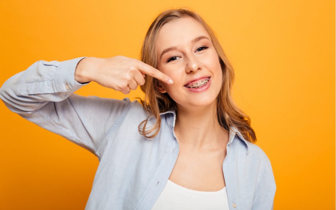 Learning More About Aesthetic Orthodontic Benefit And Treatment Option
