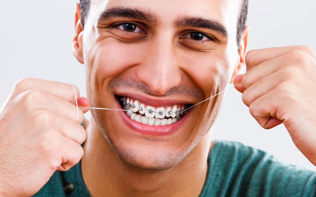 Tricks To Make Flossing With Braces Easier