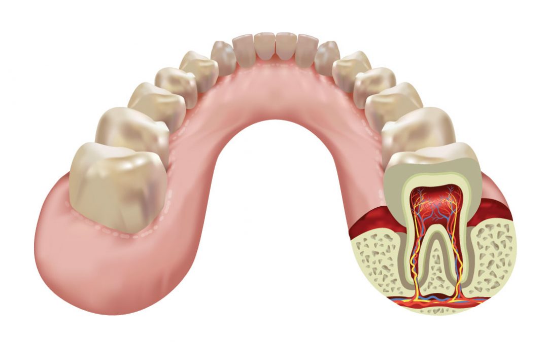 Periodontal Charting Saves The Day