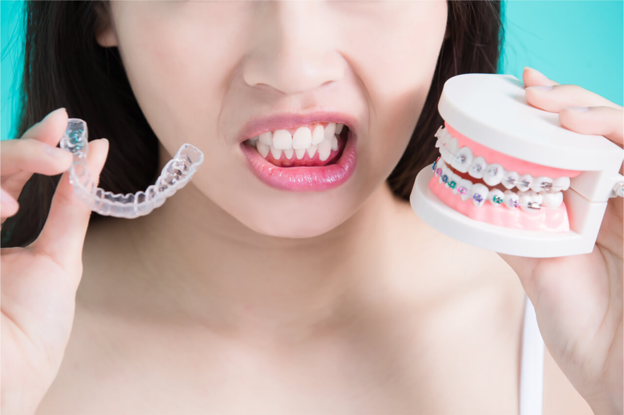 Clear braces vs. Metal braces: What’s the difference?