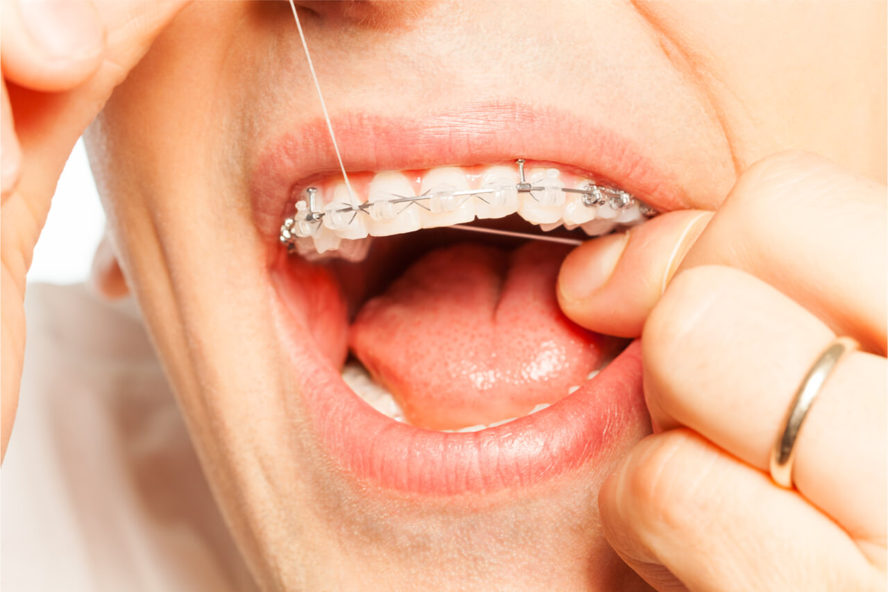 Toothbrush and dental floss for braces