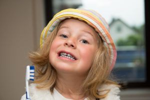 brushing without orthodontic headgear