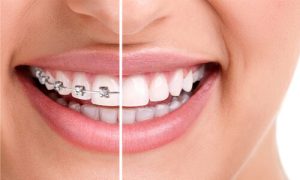 what is orthodontics treatment