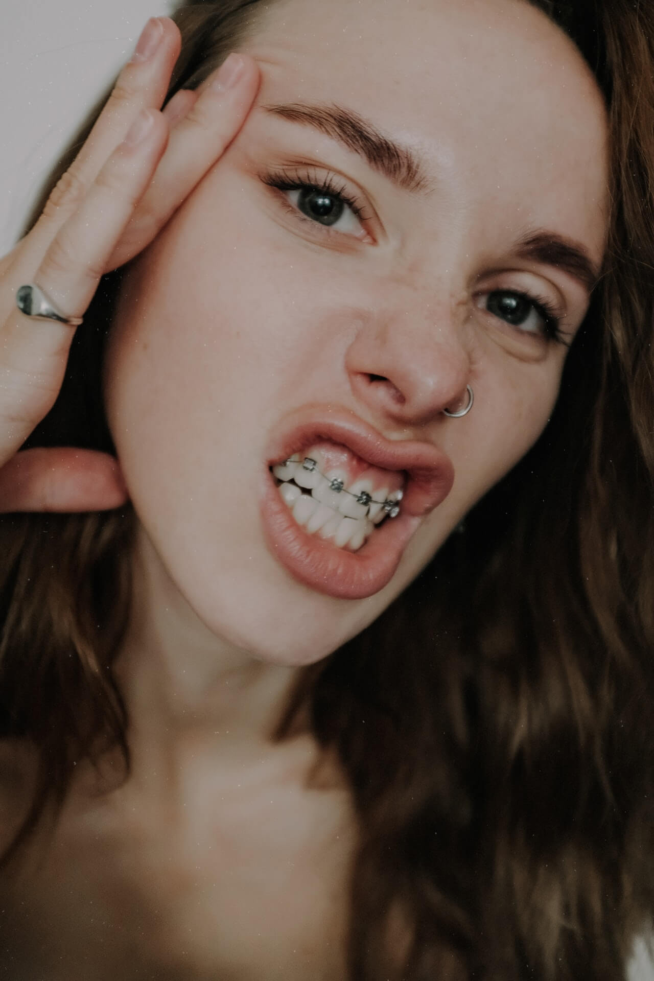 Ceramic Braces vs Metal Braces: Which Option is Best for You?