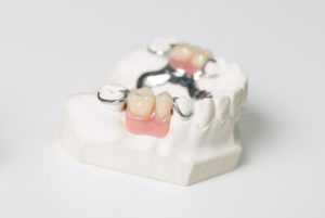 How Long Do Dentures Last partial